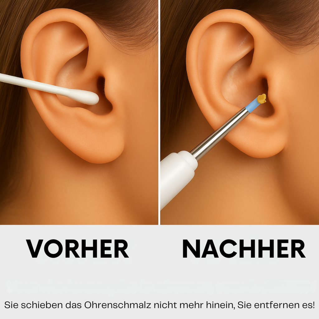 Verova™ Kit Pro – Präzises und sicheres Reinigungsgerät.
